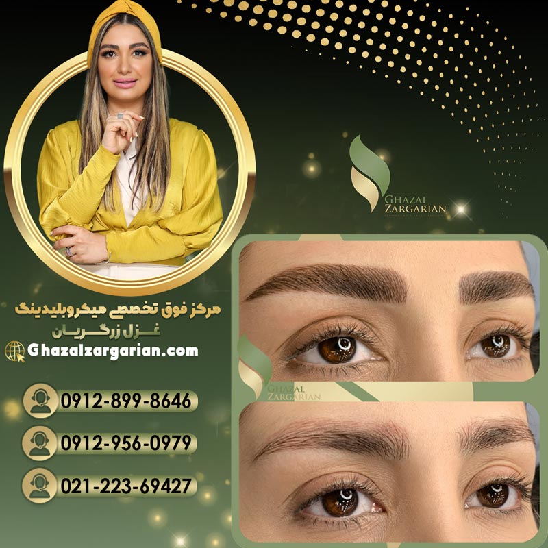 میکروبلیدینگ غزل زرگریان بر اساس فرم صورت