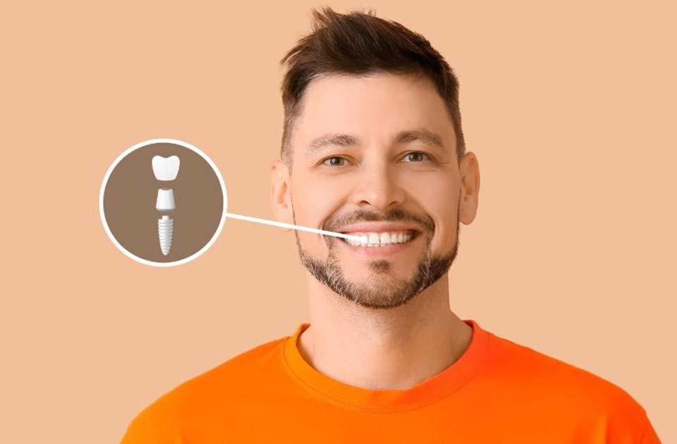 مراقبت های پس از جراحی ایمپلنت دندان 