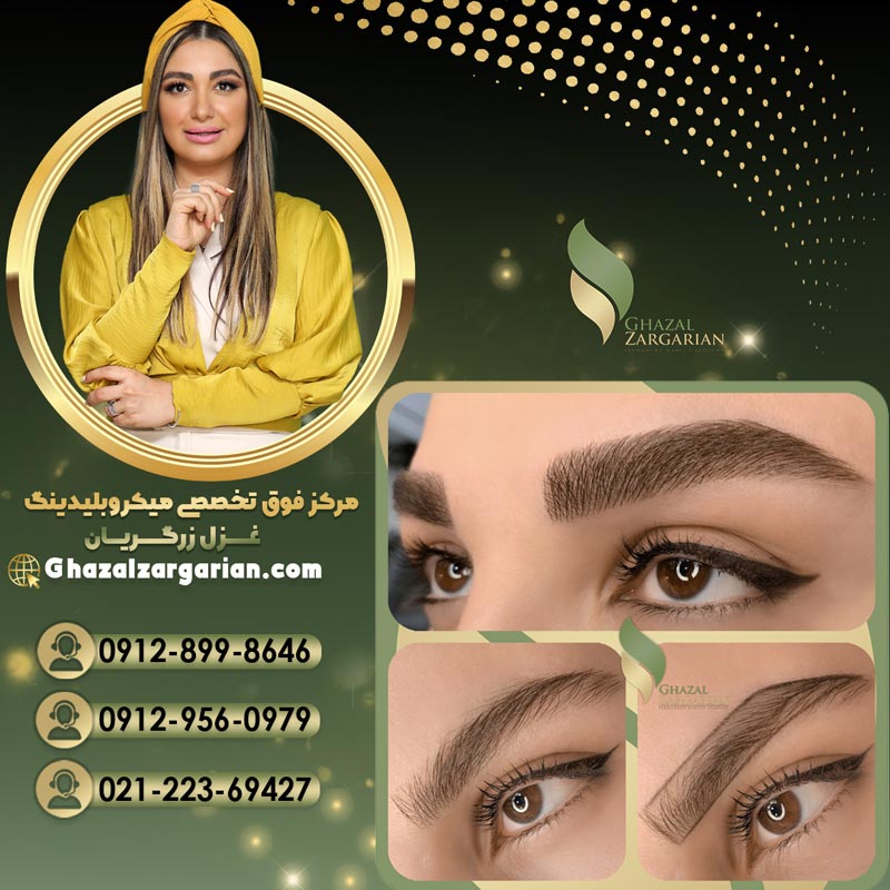 فیبروز ابرو در مرکز میکروبلیدینگ غزل زرگریان در تهران
