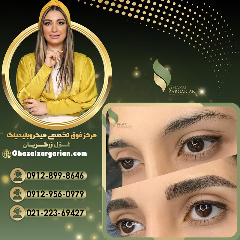 فیبروز ابرو دخترانه توسط بهترین فیبروزکار در تهران