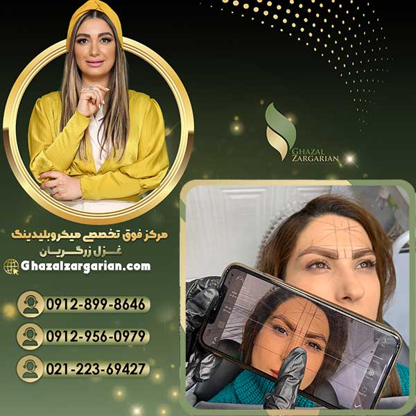 بهترین مرکز میکرو ابرو در تهران با بهترین قیمت عالی