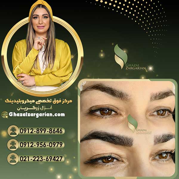 آموزش ریموو تاتو ابرو در تهران