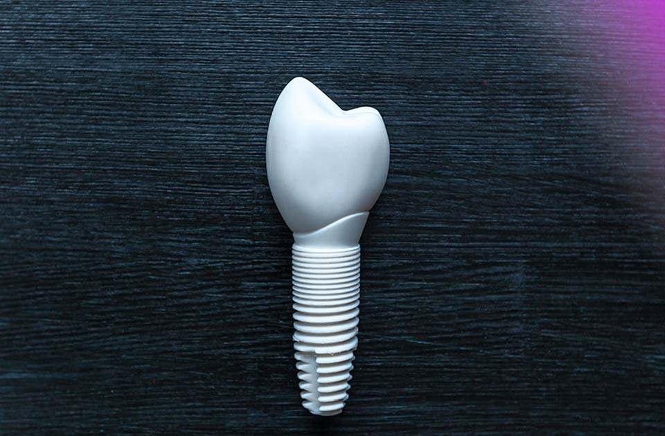 ایمپلنت سرامیکی مزایا و معایب آن 