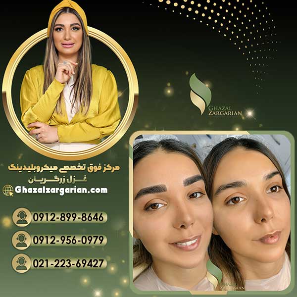 بلید ابرو در مرکز میکروبلیدینگ غزل زرگریان