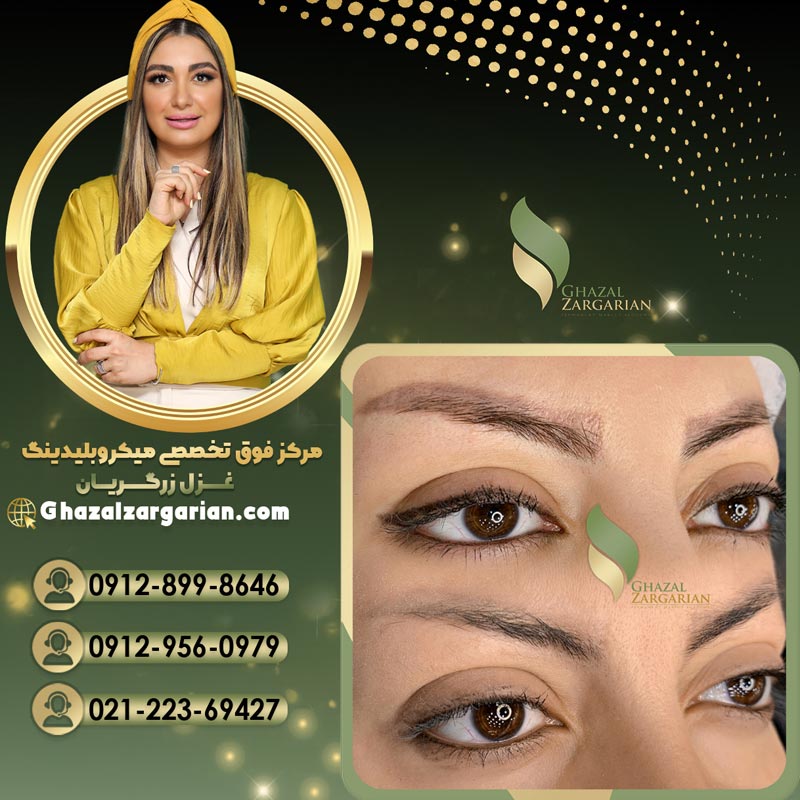 پاک کردن تاتو ابرو با مواد عالی