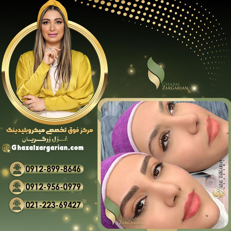 هاشور کرکی در بهترین سالن