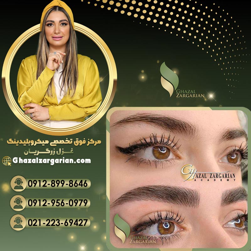 میکروبلیدینگ غزل زرگریان به صورت تضمینی
