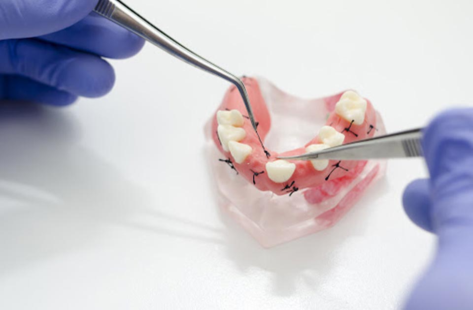 درد پس از کشیدن بخیه 