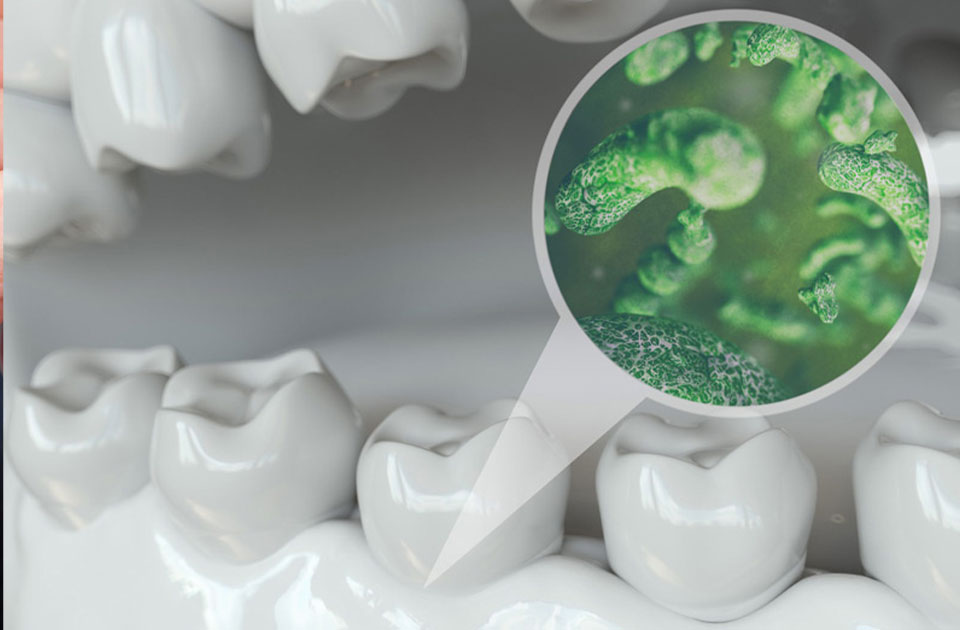 ایمپلنت دندان و عوارض آن