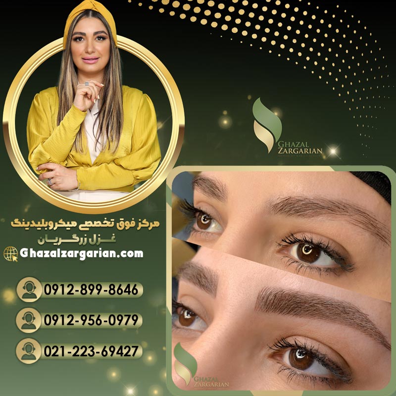 آموزش فیبروز با بروزترین تکنیک