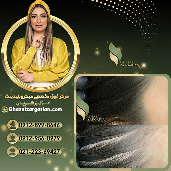 آموزش اسکالپ سر در تهران
