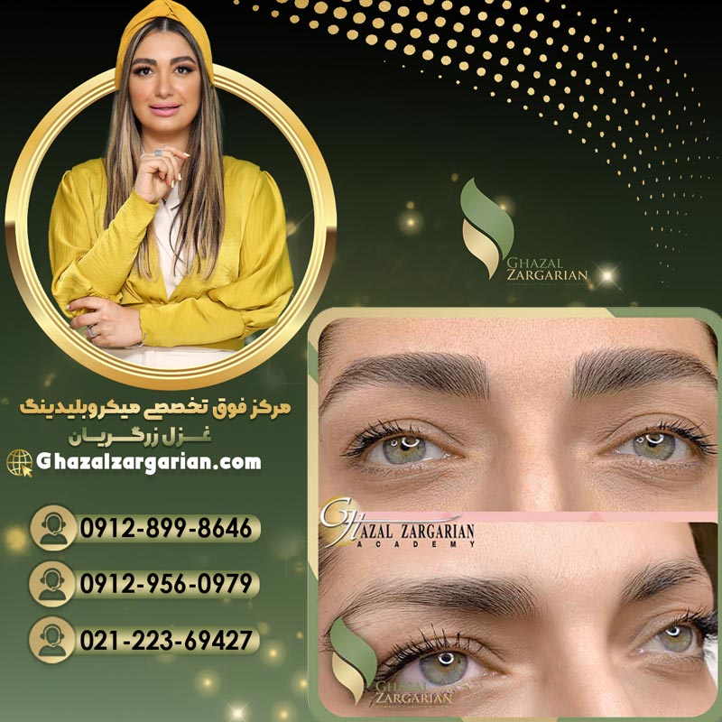 میکروبلیدینگ غزل زرگریان با متخصصان حرفه ای