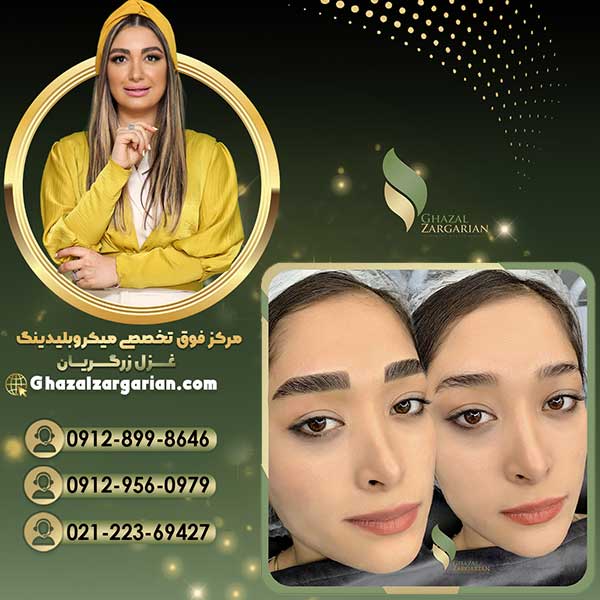 فیبروز ابرو دخترانه در مرکز میکروبلیدینگ غزل زرگریان
