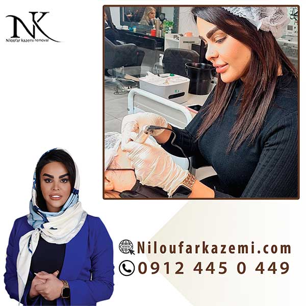 آموزش ریموو تاتو با بروزترین تکنیک با یادگیری عوامل تاثیرگذار بر روند ریموو