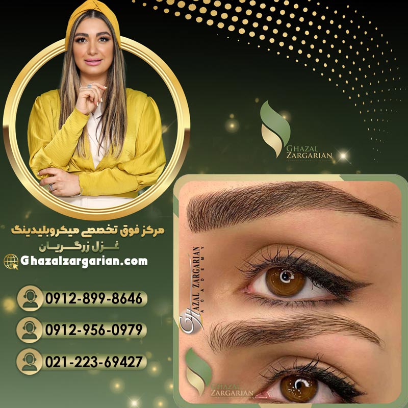 بهترین مرکز فیبروز ابرو در تهران به مدیریت غزل زرگریان