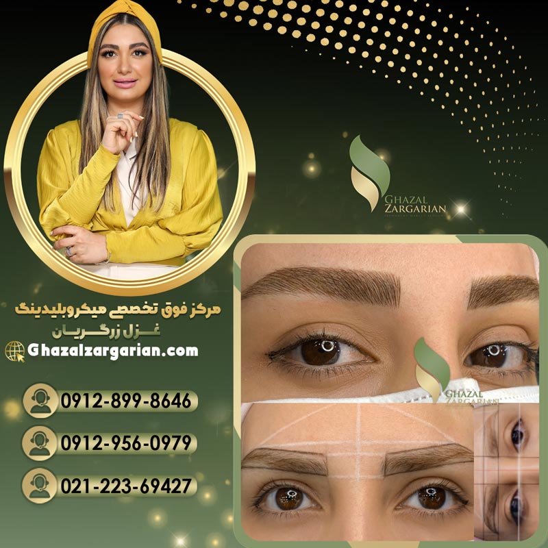 میکروبلیدینگ به صورت تخصصی