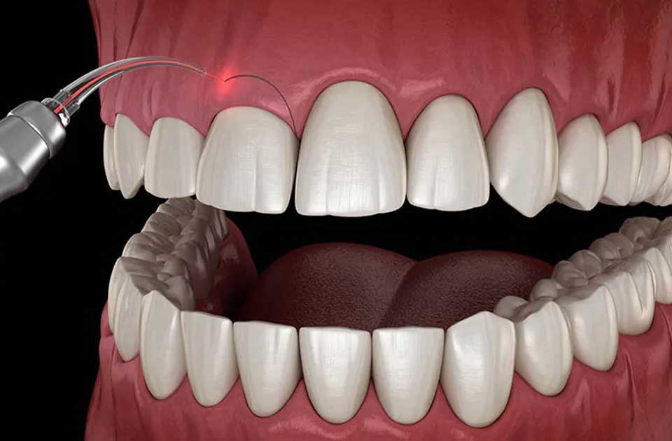 دندان ، دندانپزشکی کرج ، دندانپزشکی شبانه روزی