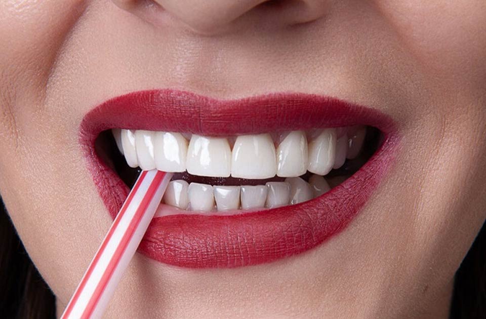 کامپوزیت دندان در کرج بهترین برند ها 