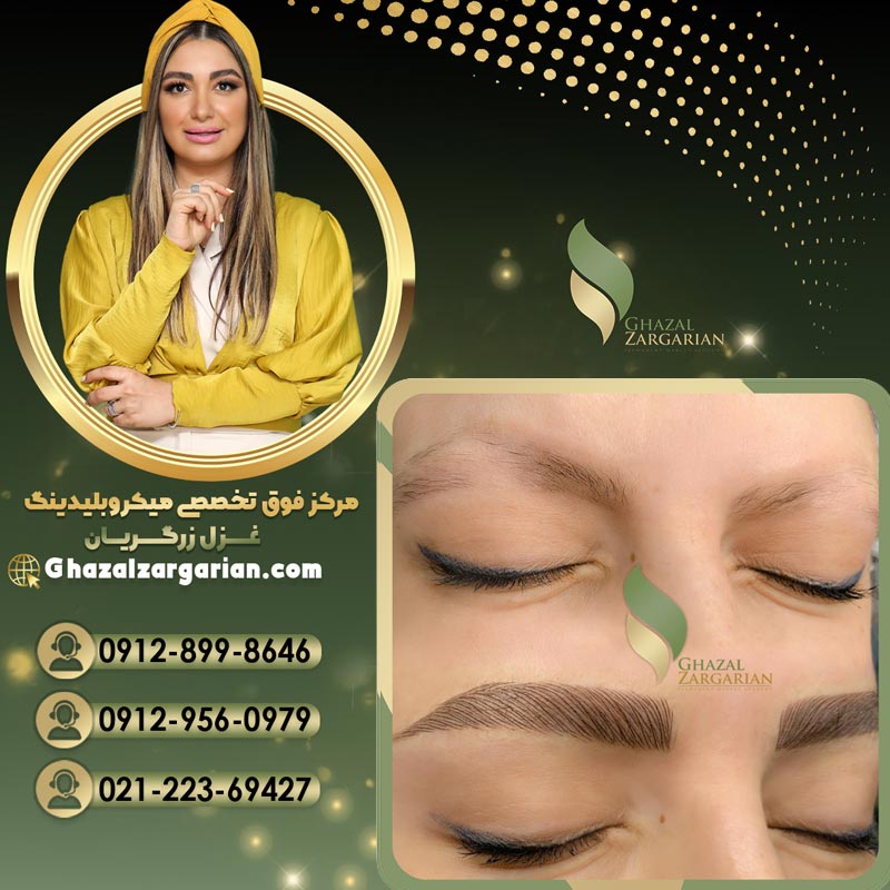 میکروبلیدینگ غزل زرگریان با مدل جذاب