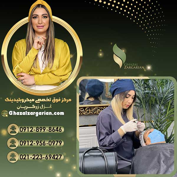 هزینه لیفت ابرو با مواد اورجینال