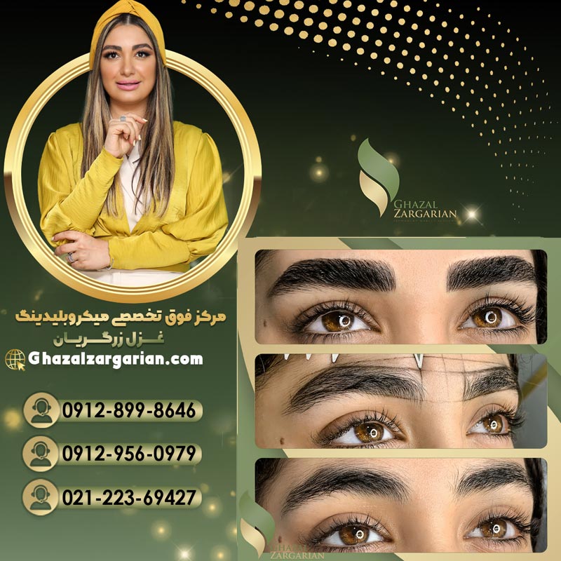 میکروبلیدینگ با ظرافت بالا