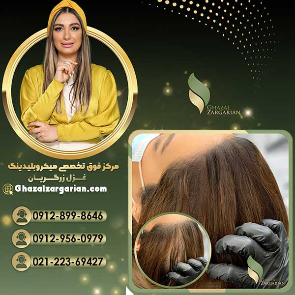 هاشور اسکالپ سر در تخصصی ترین سالن