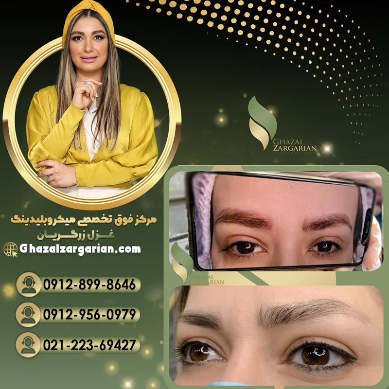 پاک کردن تاتو ابرو بدون محدودیت
