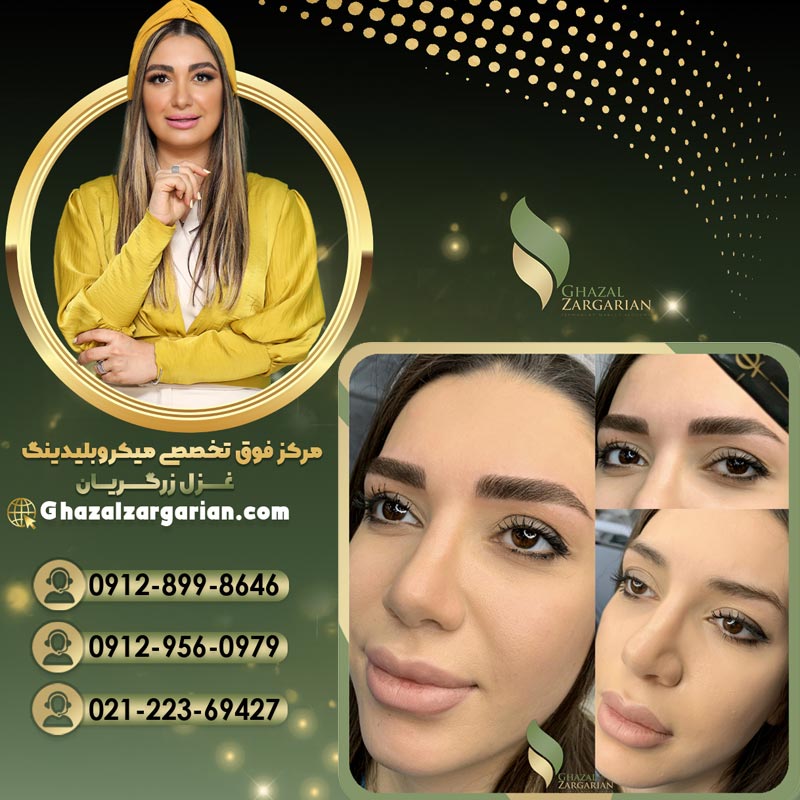 هاشور کرکی با کیفیت تضمینی
