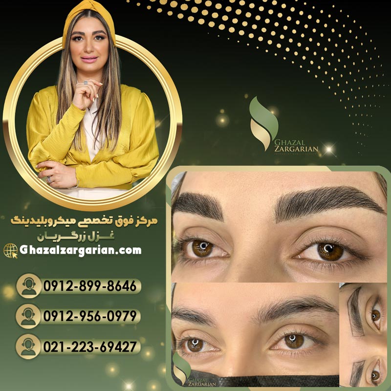 میکروبلیدینگ ابرو بدون عوارض و درد با بهترین تکنیک