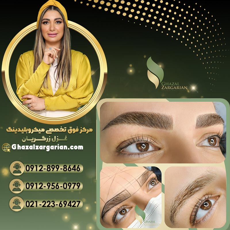 میکروبلیدینگ با بیشترین مزایا