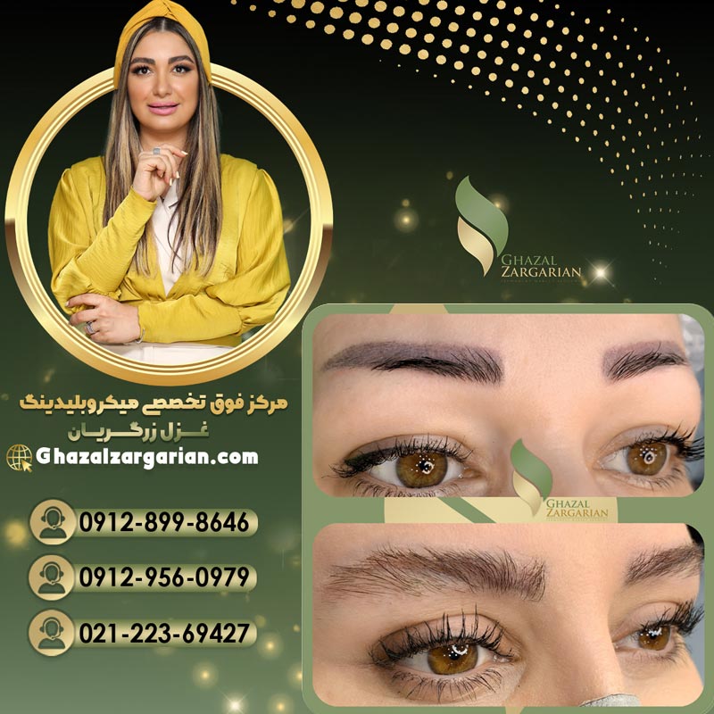 پاک کردن میکروبلیدینگ ابرو با متخصص مجرب
