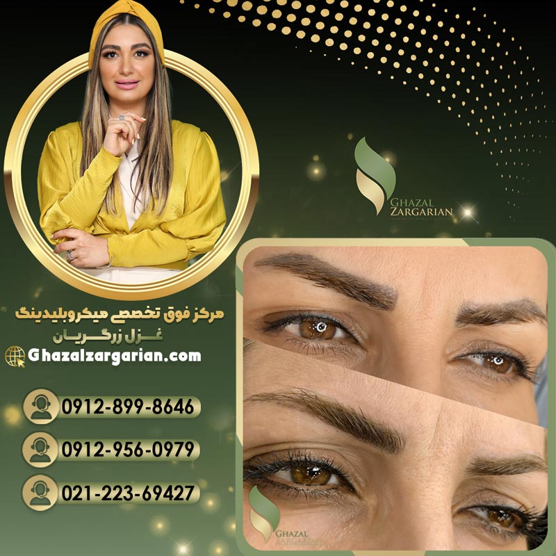 ریموو تاتو ابرو با تکنیک های تخصصی
