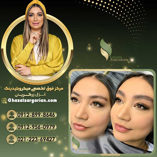 قیمت لیفت و لمنیت ابرو با بهترین تکنیک ها