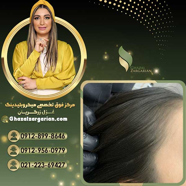 آموزش اسکالپ سر با مدرک فنی و حرفه ای