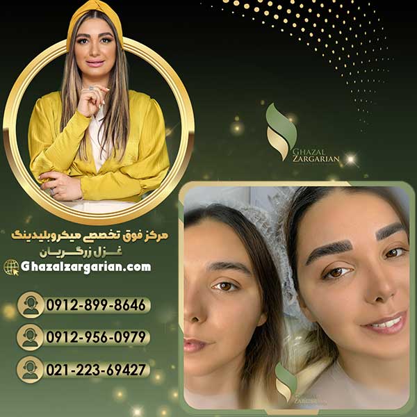 فیبروز ابرو دخترانه با بهترین قیمت به نسبت کیفیت