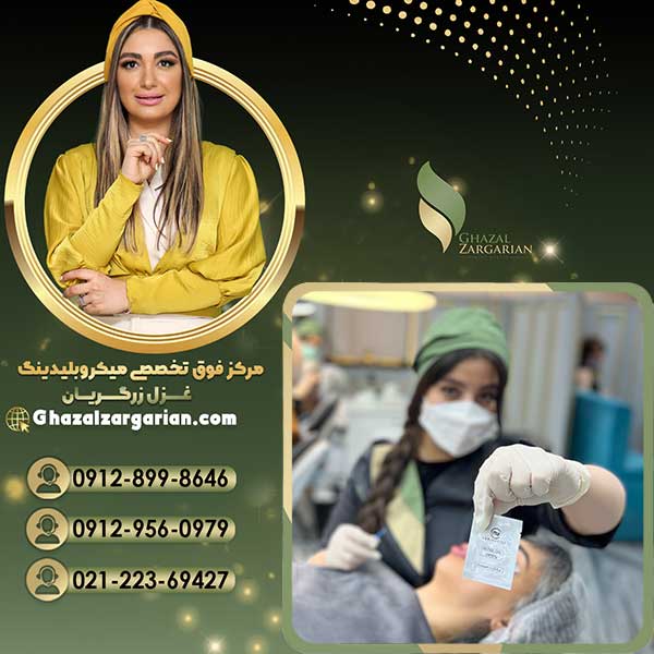 هاشور کرکی در مرکز غزل زرگریان