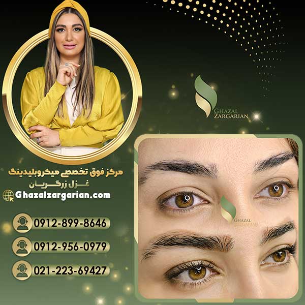 آموزش ریموو ابرو با ریموور باکیفیت