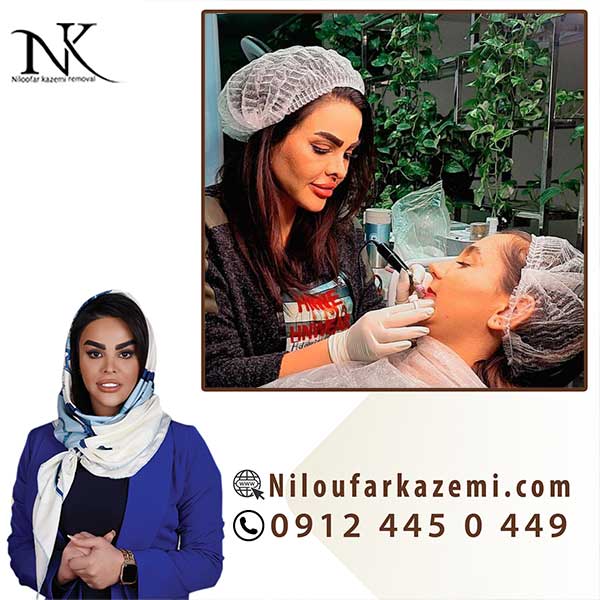 ریموو تاتو خط لب با ریموورهای ارگانیک و گیاهی