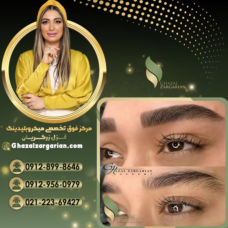 فیبروز ابرو با افراد متخصص