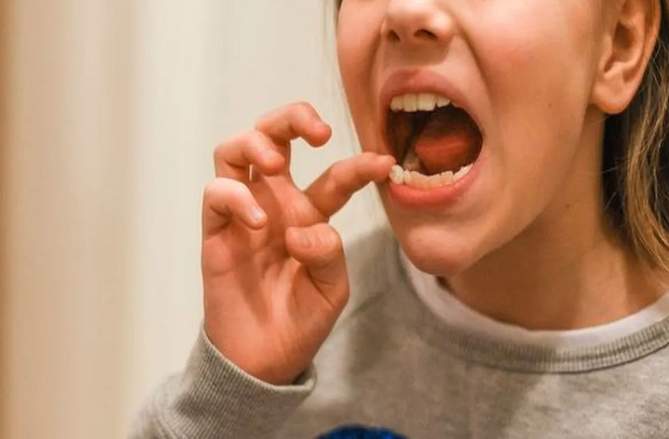 لق شدن دندان عصب کشی شده 