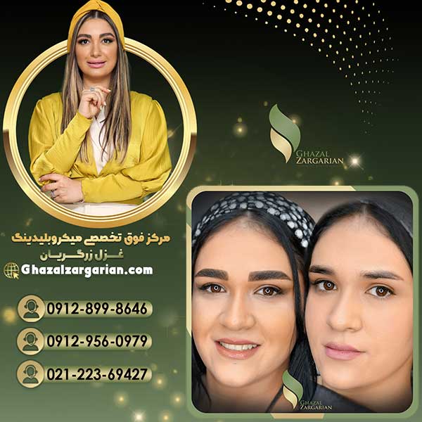 بهترین سالن فیبروز در شمال تهران با بهترین متخصص