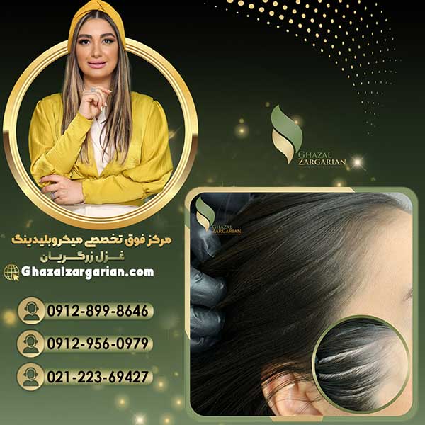 هاشور اسکالپ سر در مرکز تخصصی